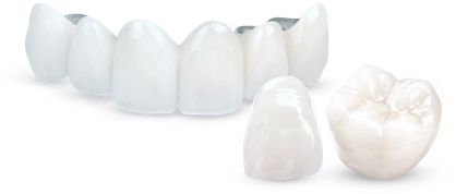 Porcelain Crowns