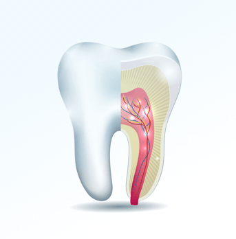 Root Canals